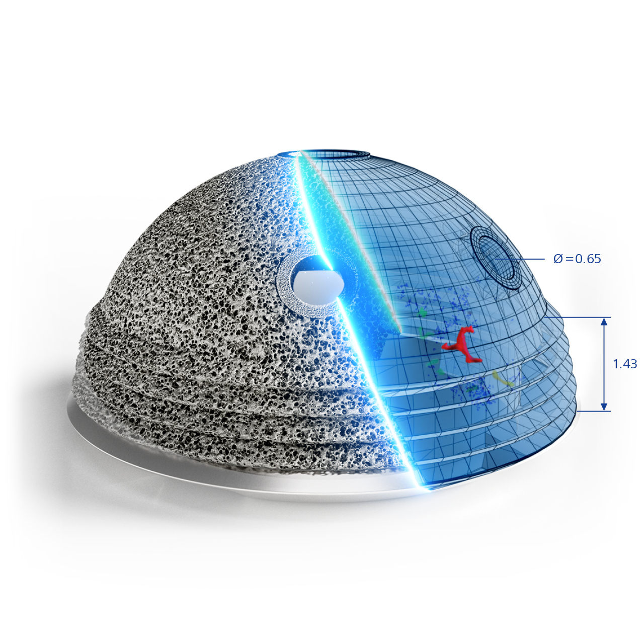 3D gedrucktes Hüftimplantat