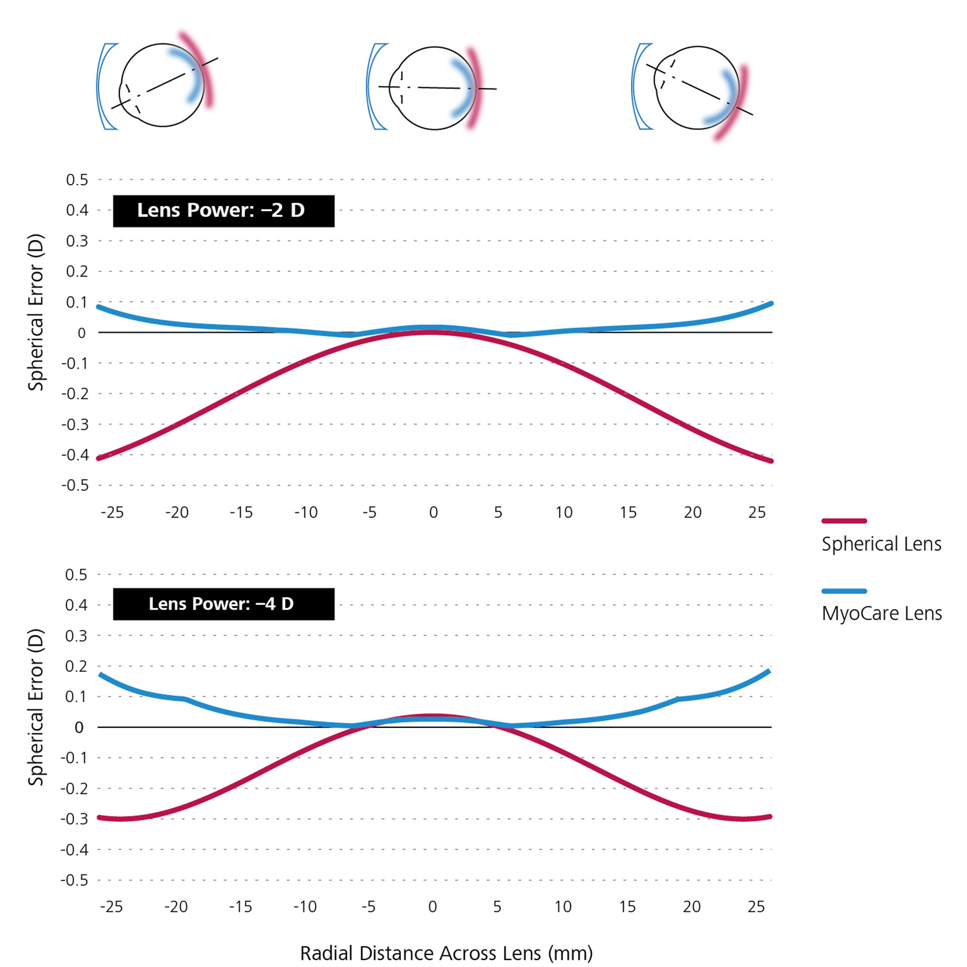 Deux graphiques linéaires montrent la simulation mathématique comparative des verres unifocaux sphériques (en rouge) et des verres MyoCare (en bleu).