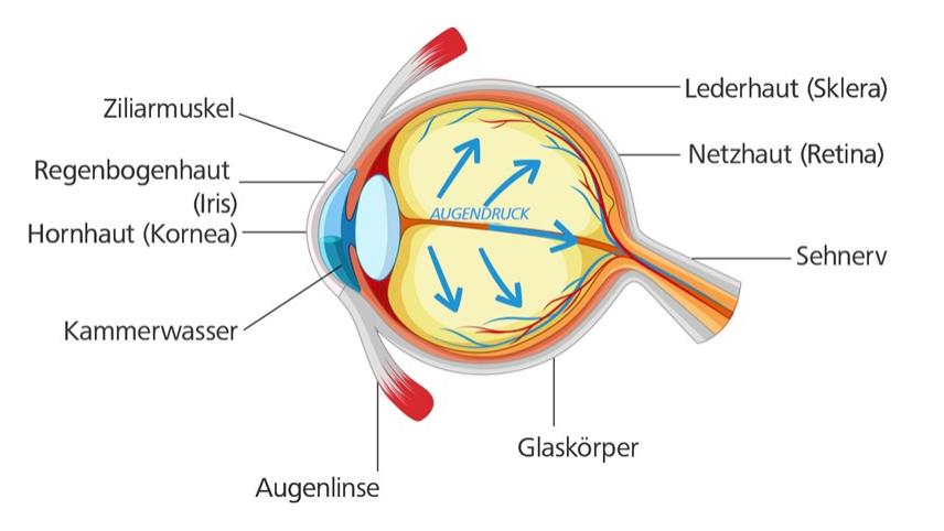 Auge mit Grünem Star: Der Augendruck steigt an und schädigt den Sehnerv.