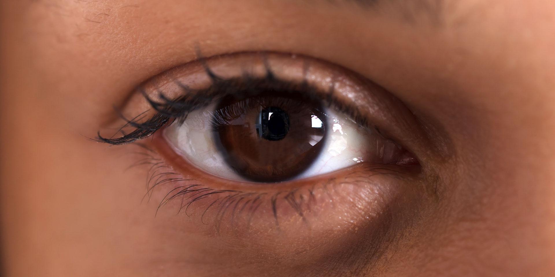 Yeux cernés